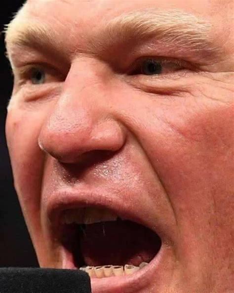 Brock lesnar’s teeth - 9GAG