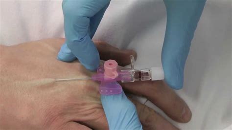 Cannulation- How to insert a cannula. One Minute Edition. Medicine in a Nutshell. IV Access ...