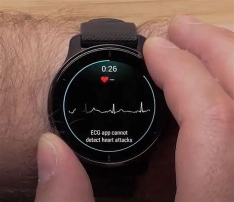 7 Best Smartwatches with ECG (FDA Approved) in 2024