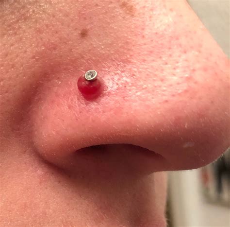 Nose Piercing Infection Bubble