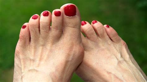 7 ways to treat bunions without surgery | HealthPartners Blog