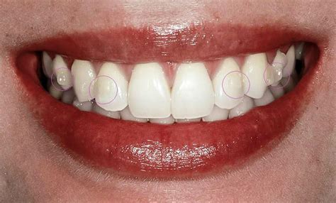 Traitement d’orthodontie : les 5 étapes essentielles