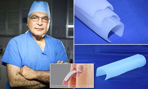 Silicone penis implant adds two inches to girth AND length and lasts ...