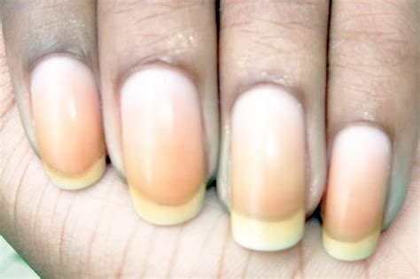 What Causes Nail Discoloration & How to Treat It | We Heart Nails