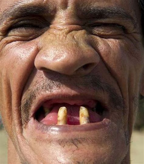 Funny Old Man With No Teeth