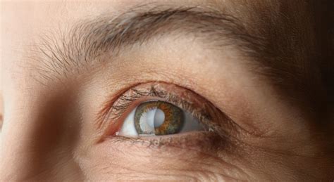 Eye Diseases Linked to Sun Damage | Ophthalmologist in Rapid City, SD ...