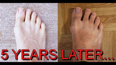 Incredible 5 Year Transformation Wearing Barefoot Shoes! - YouTube