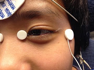 Electroretinography | Drack Lab