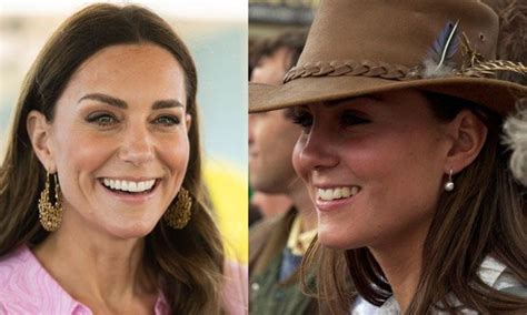 Kate Middleton teeth: what has Duchess of Cambridge done to her smile ...