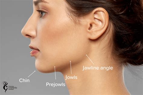 Jawline Filler Melbourne - Victorian Cosmetic Institute