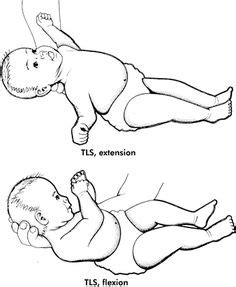 symmetrical tonic labyrinthine reflex | Primitive reflexes, Learning disabilities, Nbcot exam prep