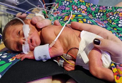 Premature birth story: '2lb 3oz baby fought his life'