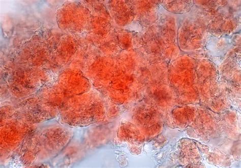 Adipose tissue under the microscope appearing as red blobs on a white ...