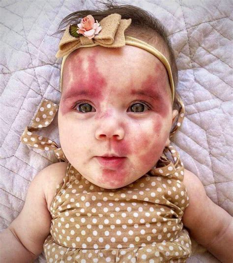 Mom paints face to look like daughter’s heart-shaped port wine ...