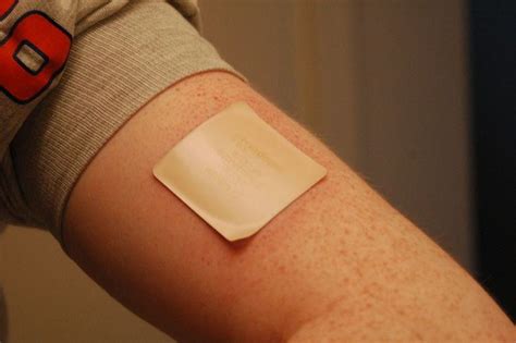 Transdermal patch - Alchetron, The Free Social Encyclopedia