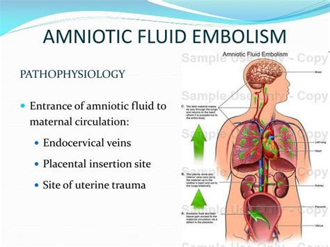 PPT - Lecture 18 ABNORMALITIES OF FETAL MEMBRANES & AMNIOTIC FLUID ...