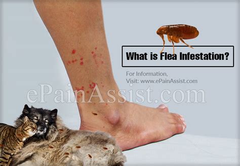 What is Flea Infestation & How to Know if You Got Bitten By A Flea?