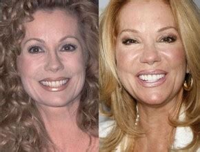 Kathie Lee Gifford before and after plastic surgery 02 | Celebrity ...