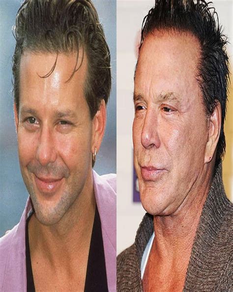 Celebrity Before And After Plastic Surgery Disasters