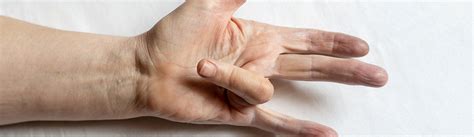 Dupuytren's Contracture Treatment | Sydney Orthopaedic Surgeon