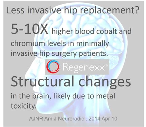 Less Invasive Hip Replacement? Metal Toxicity and Brain Changes in Hip Resurfacing Patients ...