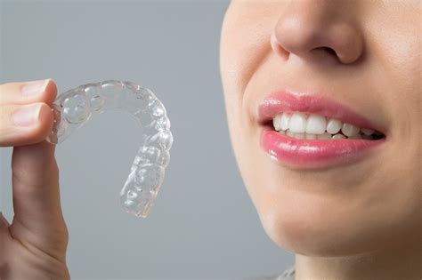 Orthodontic Retainer Wholesale at Katie Jones blog