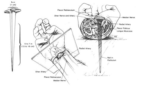 Jesus of Nazareth Crucifixion Photo Gallery 17 - Medical drawings of ...