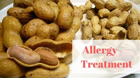 New Peanut Allergy Treatment Holds Promise - YouTube