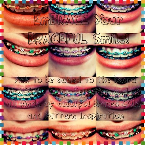 35+ Best Colors To Get For Braces PNG