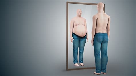 Body dysmorphic disorder (BDD): Symptoms, Causes, and Treatment