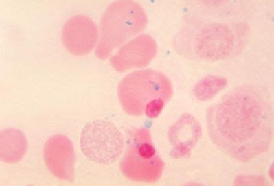 Hematopoiesis and Bone Marrow Histology - Sideroblast - histology slide