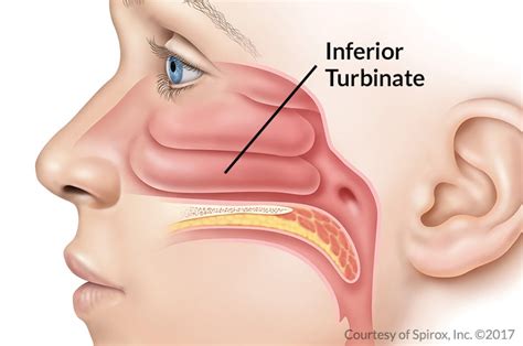 Nasal Turbinate Enlargement Las Vegas NV - Nevada Sinus Relief