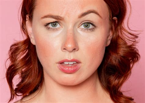 Red Blotchy Skin on Face: What It Is and How to Get Rid of It