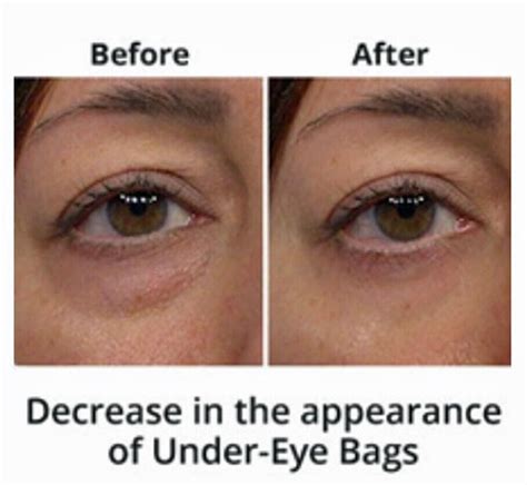 Under Eye Cream Remove Dark Circles Bags Face Lines Ageless Wrinkles Best | eBay