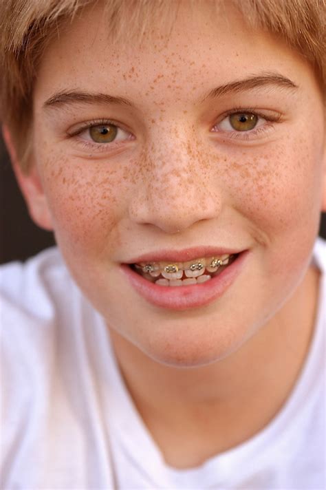 Young boy with braces | Advertising & Stock Photography Bill Robbins