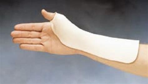 Radial Based Thumb Spica Splint