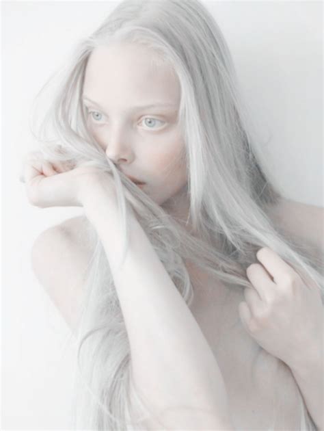 Pin by Beka on Art, Simplicity, Life | Albinism, Albino model, Photography