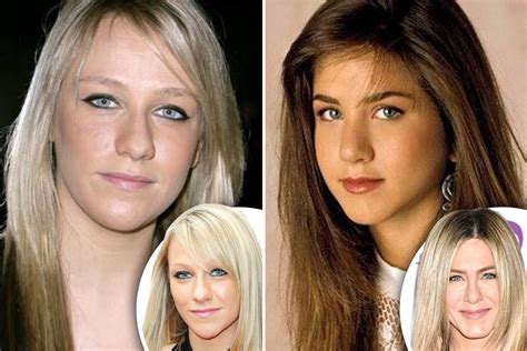 Rhinoplasty before and after: Which celebs have had nose jobs from Jennifer Aniston to James ...