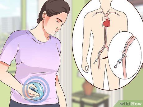 How to Recover From an Angiogram (with Pictures) - wikiHow