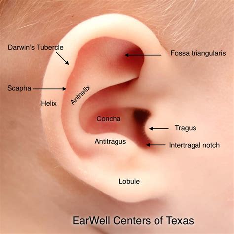 Infant Ear Deformities - EarWell Centers of Excellence