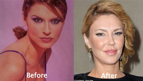 Brandi Glanville Plastic Surgery Before and After Photos