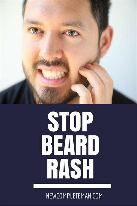 How To Stop Beard Rash For Good | Beard rash, Beard, Beard care