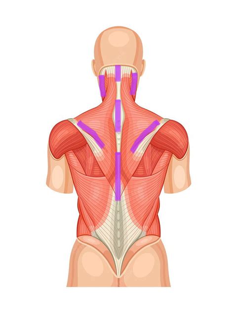 Pain in purple highlighted areas. Anyone have similar chronic pain? : r ...