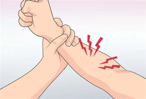 The Most 4 Common Right Arm Pain Causes - Body Pain Tips