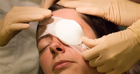 Cataract Surgery Recovery | Immediately After Surgery & Beyond