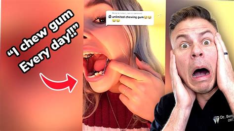 Orthodontist Reacts! Chewing Gum With Braces! - YouTube in 2023 | Receding gums, Swollen gum ...