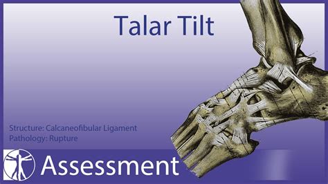 Talar Tilt Test⎟Lateral Ankle Sprain - YouTube