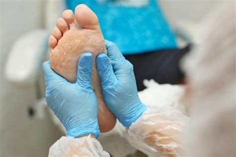 Diabetic Foot Plastic Surgery