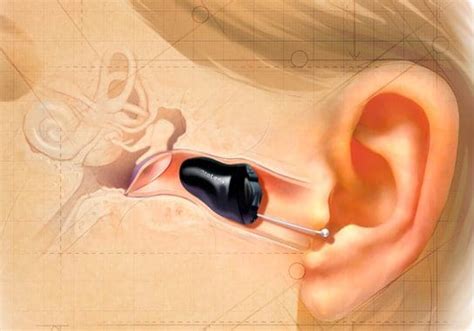 Invisible Hearing Aids: No One Will Know You’re Wearing Them