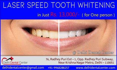 Cosmetic Dentistry - Tooth Whitening Dentist in Dilshad Garden - Tooth ...